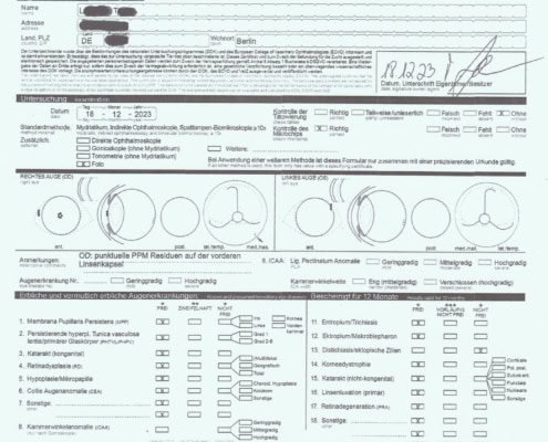 2. DOK-Augenuntersuchung